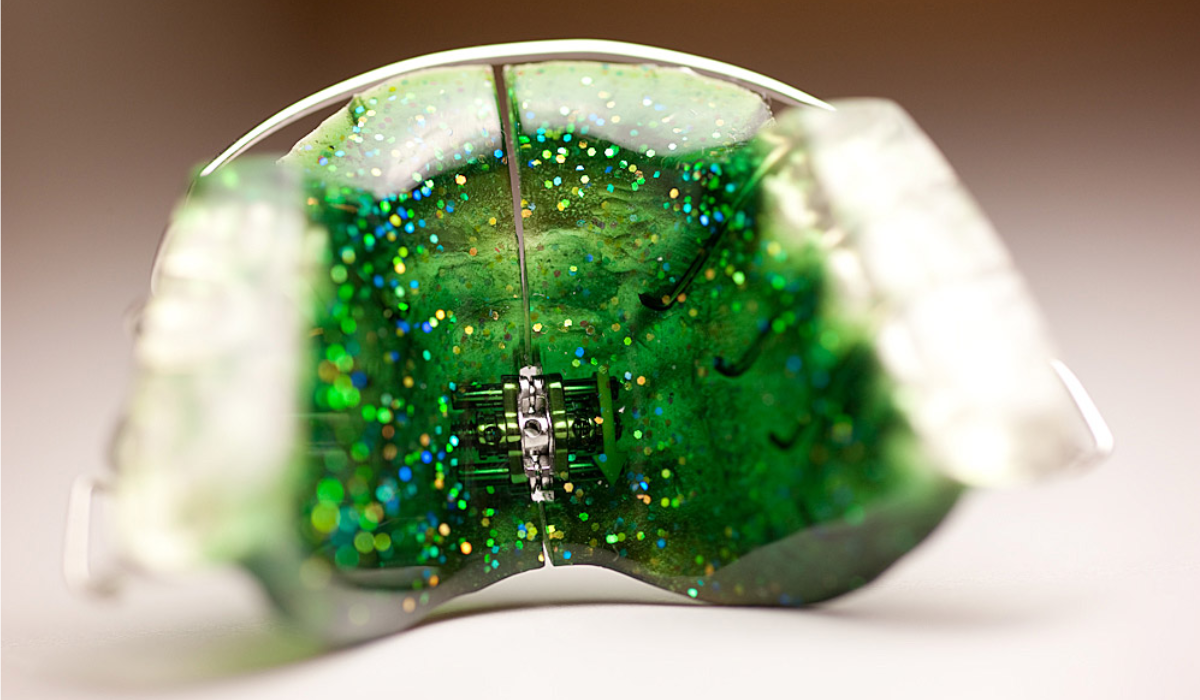 tdl Precision Orthodontics dental lab A passion for technology and people